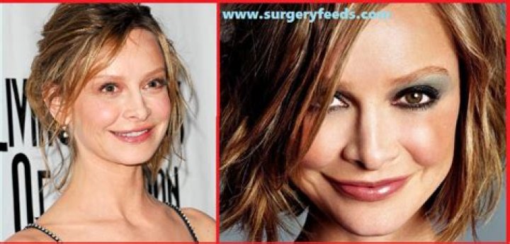 Calista Flockhart Plastic Surgery: Secrets Behind 59-Year-Old Calista's Seemless Beauty!
