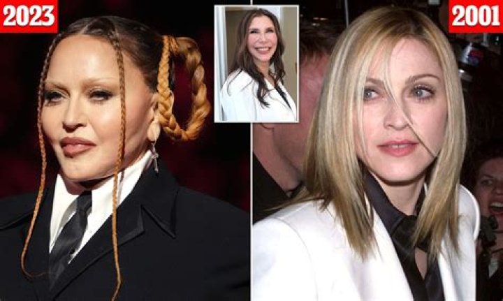 Hilary Swank Plastic Surgery Before and After