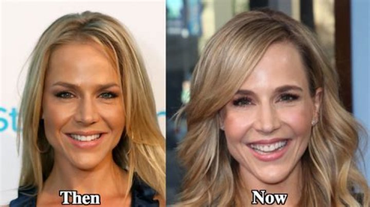 Julie Benz Plastic Surgery Before and After