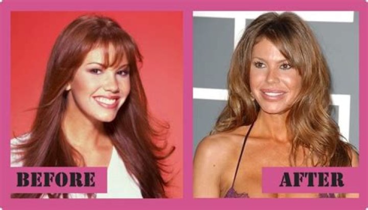 Nikki Cox Plastic Surgery Before and After