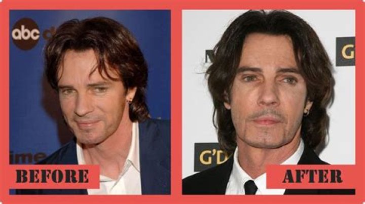 Rick Springfield Plastic Surgery: From Making Speculations to What He Said!