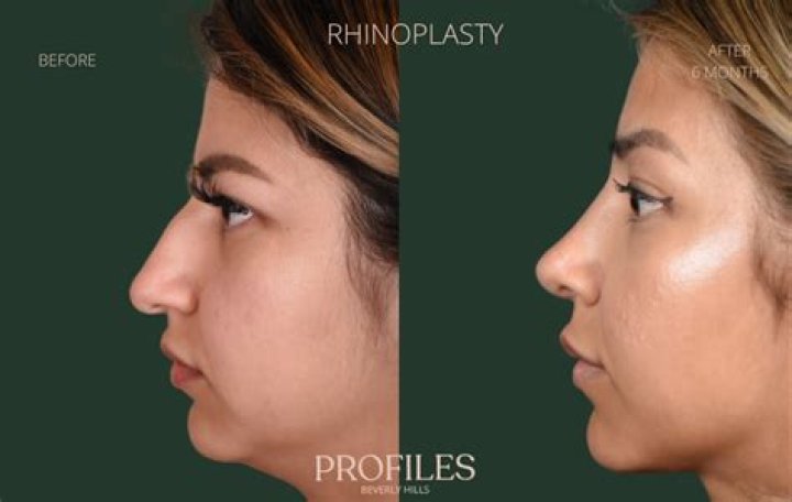 Rosmar Tan Plastic Surgery: Her Changing Looks Attributed to Her Special Skincare?